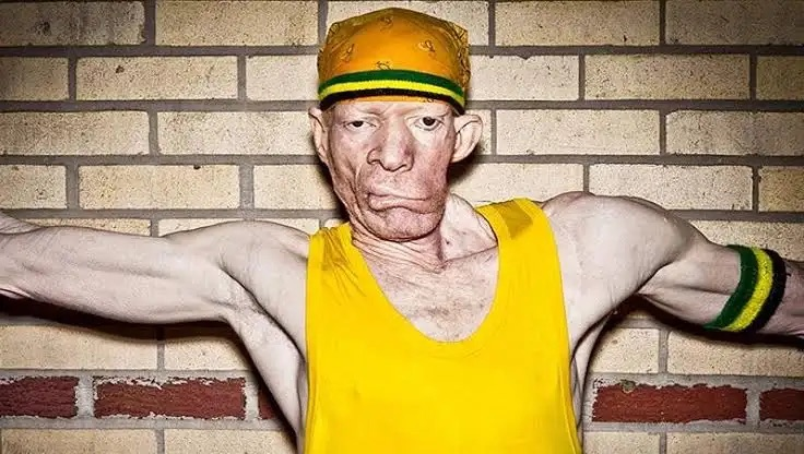 King Yellowman - Original Dancehall Legend